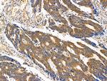 ST6GAL1 Antibody in Immunohistochemistry (Paraffin) (IHC (P))