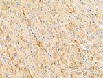 ST6GAL1 Antibody in Immunohistochemistry (Paraffin) (IHC (P))