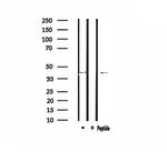 ST6GAL1 Antibody in Western Blot (WB)