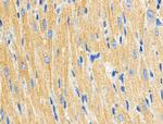 C1QC Antibody in Immunohistochemistry (Paraffin) (IHC (P))