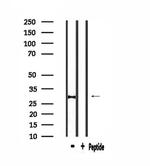 C1QC Antibody in Western Blot (WB)