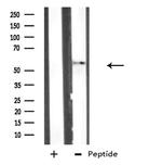 ATG4D Antibody in Western Blot (WB)