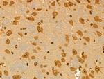 PRIM1 Antibody in Immunohistochemistry (Paraffin) (IHC (P))