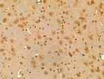 PRIM1 Antibody in Immunohistochemistry (Paraffin) (IHC (P))