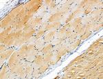 PRIM1 Antibody in Immunohistochemistry (Paraffin) (IHC (P))