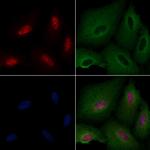 POLR1B Antibody in Immunocytochemistry (ICC/IF)