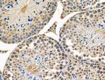 POLR1B Antibody in Immunohistochemistry (Paraffin) (IHC (P))