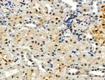 POLR1B Antibody in Immunohistochemistry (Paraffin) (IHC (P))