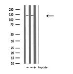 POLR1B Antibody in Western Blot (WB)