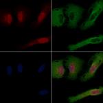 RNF111 Antibody in Immunocytochemistry (ICC/IF)