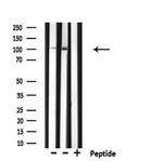 RNF111 Antibody in Western Blot (WB)