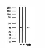 ELOVL6 Antibody in Western Blot (WB)