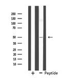 FOXN4 Antibody in Western Blot (WB)