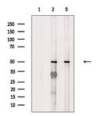 FOXN4 Antibody in Western Blot (WB)