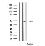 KCNN4 Antibody in Western Blot (WB)