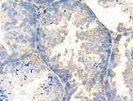 MGST2 Antibody in Immunohistochemistry (Paraffin) (IHC (P))