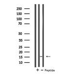 MGST2 Antibody in Western Blot (WB)