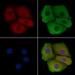 MRPL3 Antibody in Immunocytochemistry (ICC/IF)