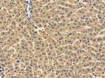 MRPL3 Antibody in Immunohistochemistry (Paraffin) (IHC (P))