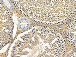 MRPL3 Antibody in Immunohistochemistry (Paraffin) (IHC (P))