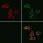 TOMM20 Antibody in Immunocytochemistry (ICC/IF)