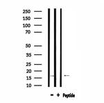 TOMM20 Antibody in Western Blot (WB)