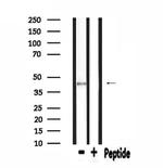 SLC16A13 Antibody in Western Blot (WB)