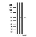 SLC16A3 Antibody in Western Blot (WB)