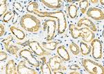 NDUFA4L2 Antibody in Immunohistochemistry (Paraffin) (IHC (P))