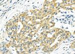 NDUFA4L2 Antibody in Immunohistochemistry (Paraffin) (IHC (P))