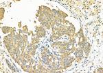 NDUFA4L2 Antibody in Immunohistochemistry (Paraffin) (IHC (P))