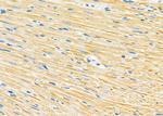 NDUFA4L2 Antibody in Immunohistochemistry (Paraffin) (IHC (P))