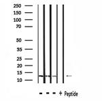 NDUFA4L2 Antibody in Western Blot (WB)