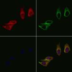 ME1 Antibody in Immunocytochemistry (ICC/IF)