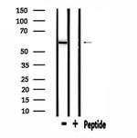 ME1 Antibody in Western Blot (WB)