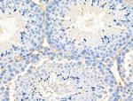 Neurocan Antibody in Immunohistochemistry (Paraffin) (IHC (P))