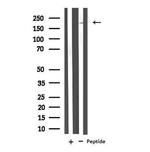 Neurocan Antibody in Western Blot (WB)