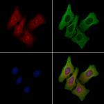 NOLC1 Antibody in Immunocytochemistry (ICC/IF)