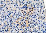 PRRX1 Antibody in Immunohistochemistry (Paraffin) (IHC (P))