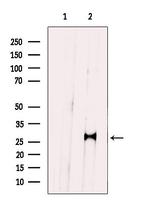 PRRX1 Antibody in Western Blot (WB)