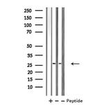 PRRX1 Antibody in Western Blot (WB)