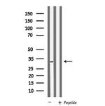 KCNK6 Antibody in Western Blot (WB)