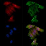 FNTB Antibody in Immunocytochemistry (ICC/IF)