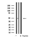 FNTB Antibody in Western Blot (WB)