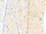 PDK1 Antibody in Immunohistochemistry (Paraffin) (IHC (P))