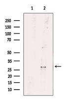 RAB26 Antibody in Western Blot (WB)