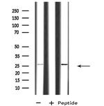 RAB26 Antibody in Western Blot (WB)