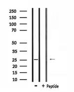 RAB38 Antibody in Western Blot (WB)