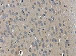 ARHGDIG Antibody in Immunohistochemistry (Paraffin) (IHC (P))