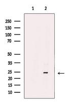 ARHGDIG Antibody in Western Blot (WB)